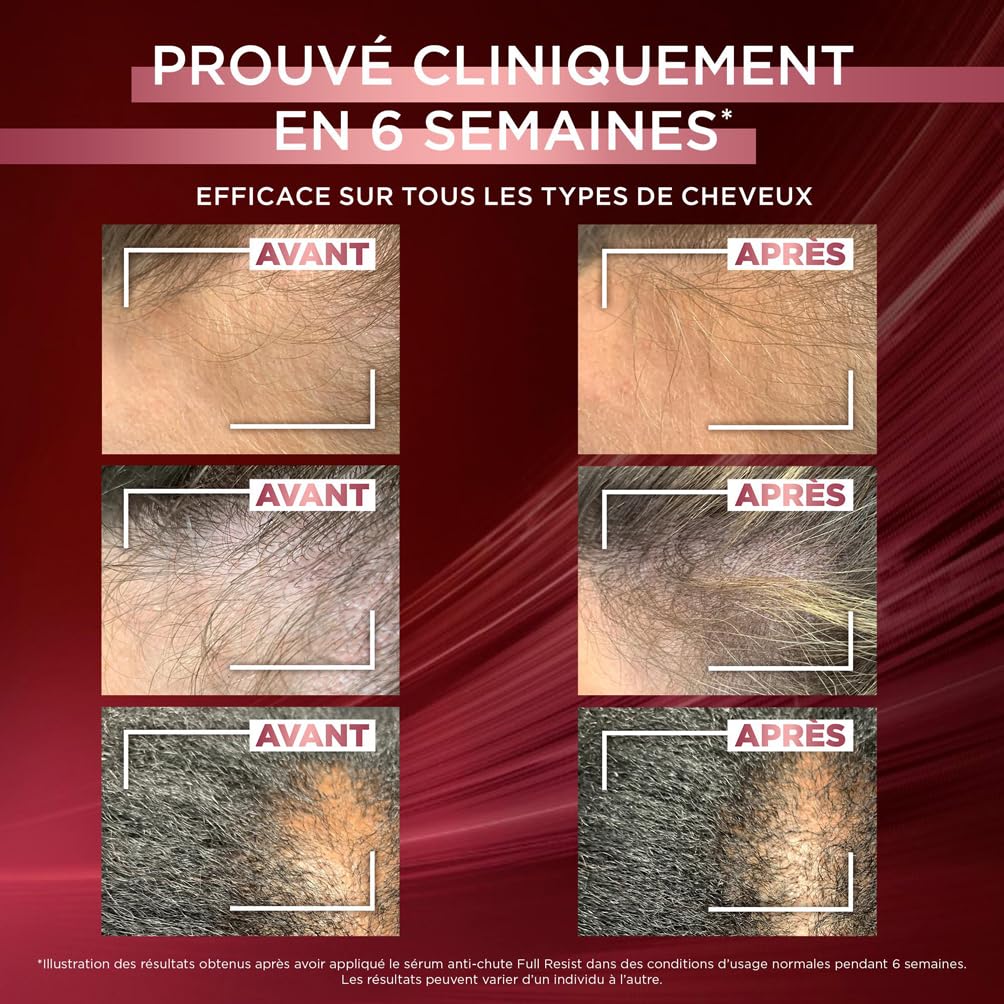 l-or-al-paris-els-ve-full-resist-s-rum-anti-chute-aminexil-1-5-lot-de-3-x-102-ml image 2