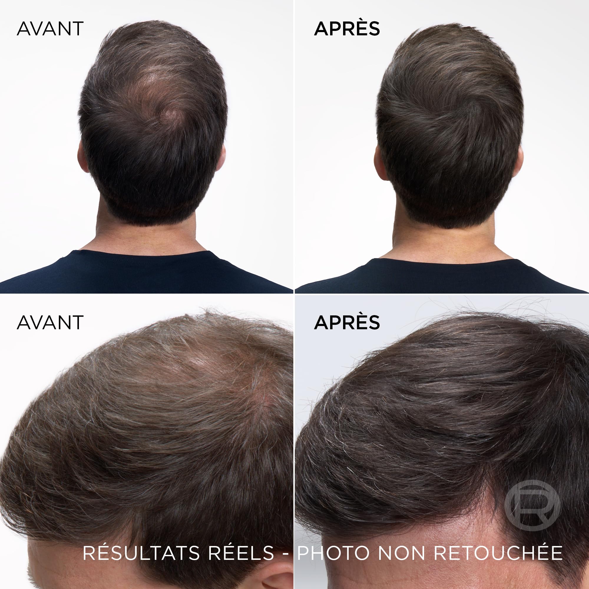 l-or-al-paris-magic-retouch-spray-racines-ch-tain-fonc-2x75ml image 4