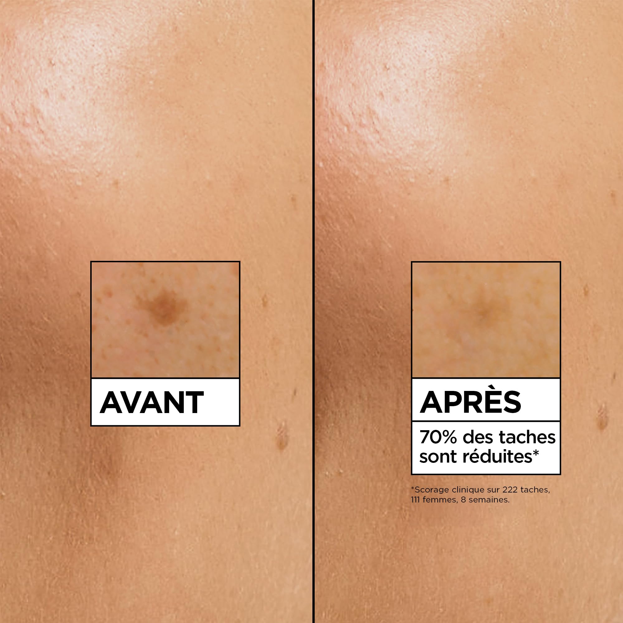 garnier-skin-active-s-rum-clat-anti-taches-vitamine-c-niacinamide-30-ml image 4