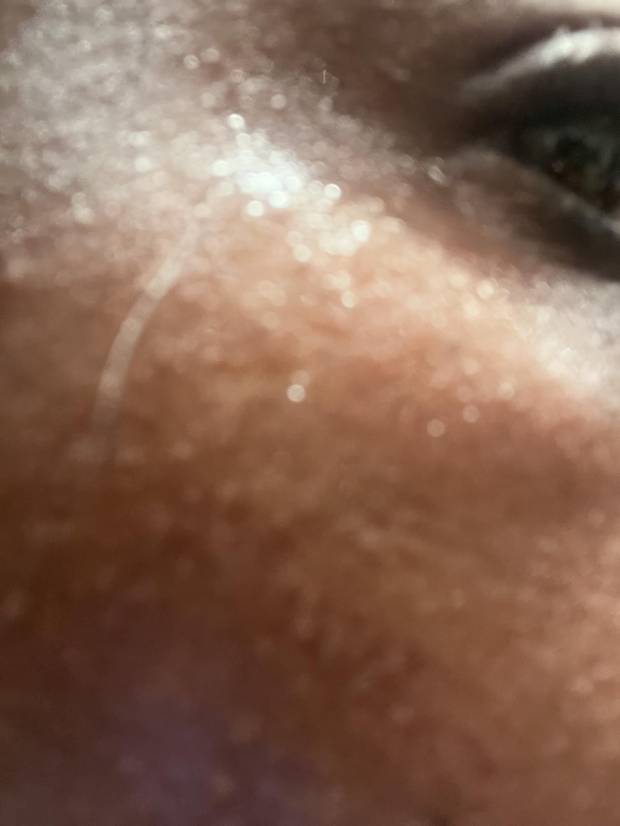 Efficace sur pores