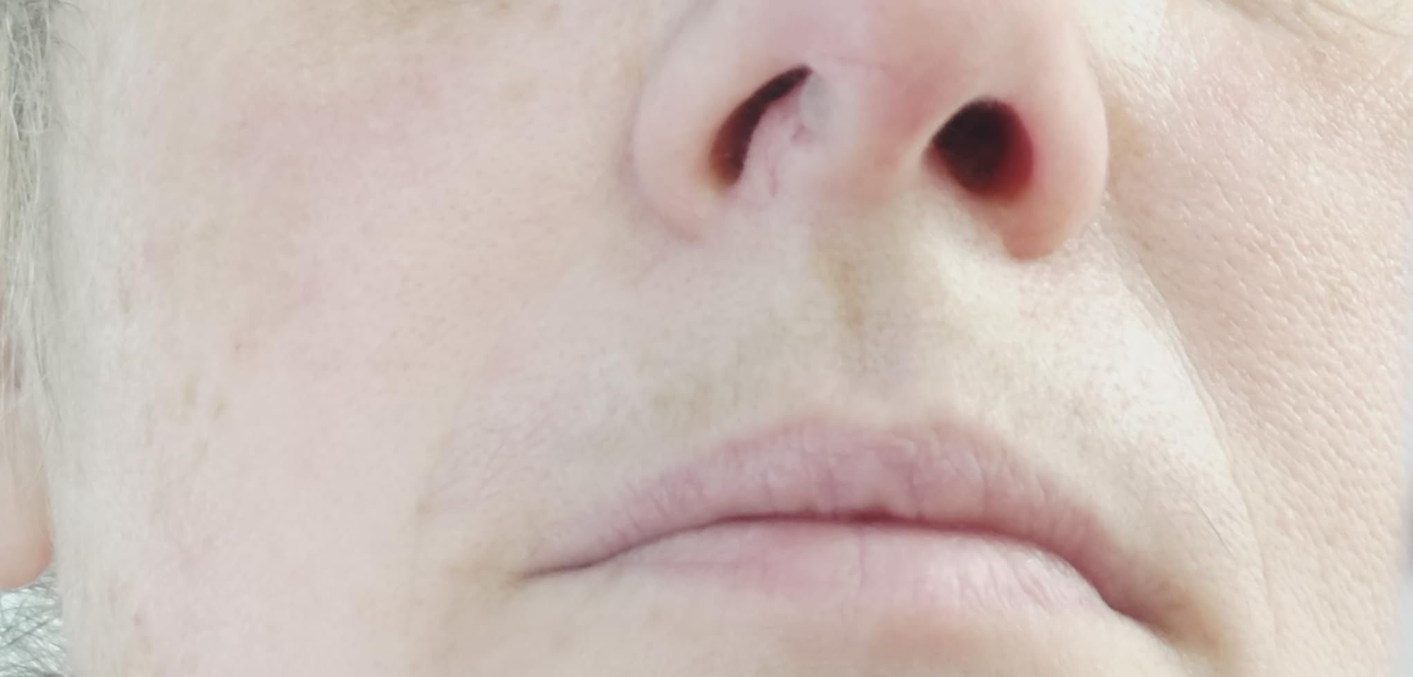 Ne tient pas sur ma peau