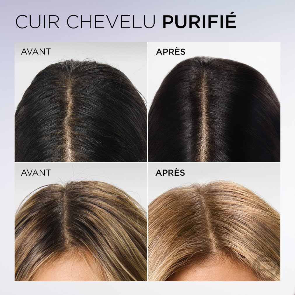 l-or-al-paris-elseve-hyaluron-pure-routine-cheveux-gras-shampooing-300-ml-s-rum- image 4