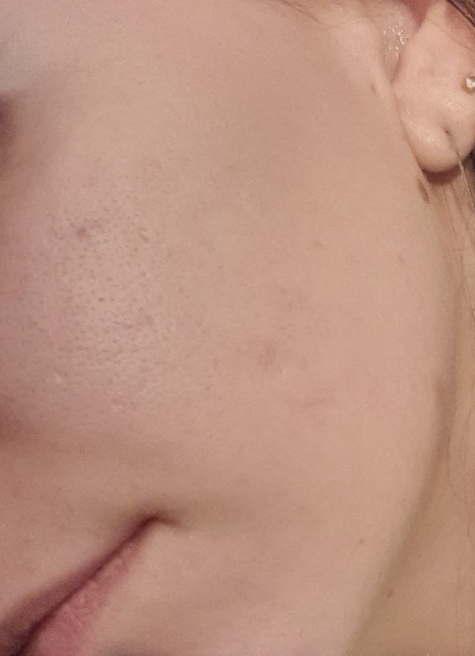Ma peau n'a jamais été aussi nette