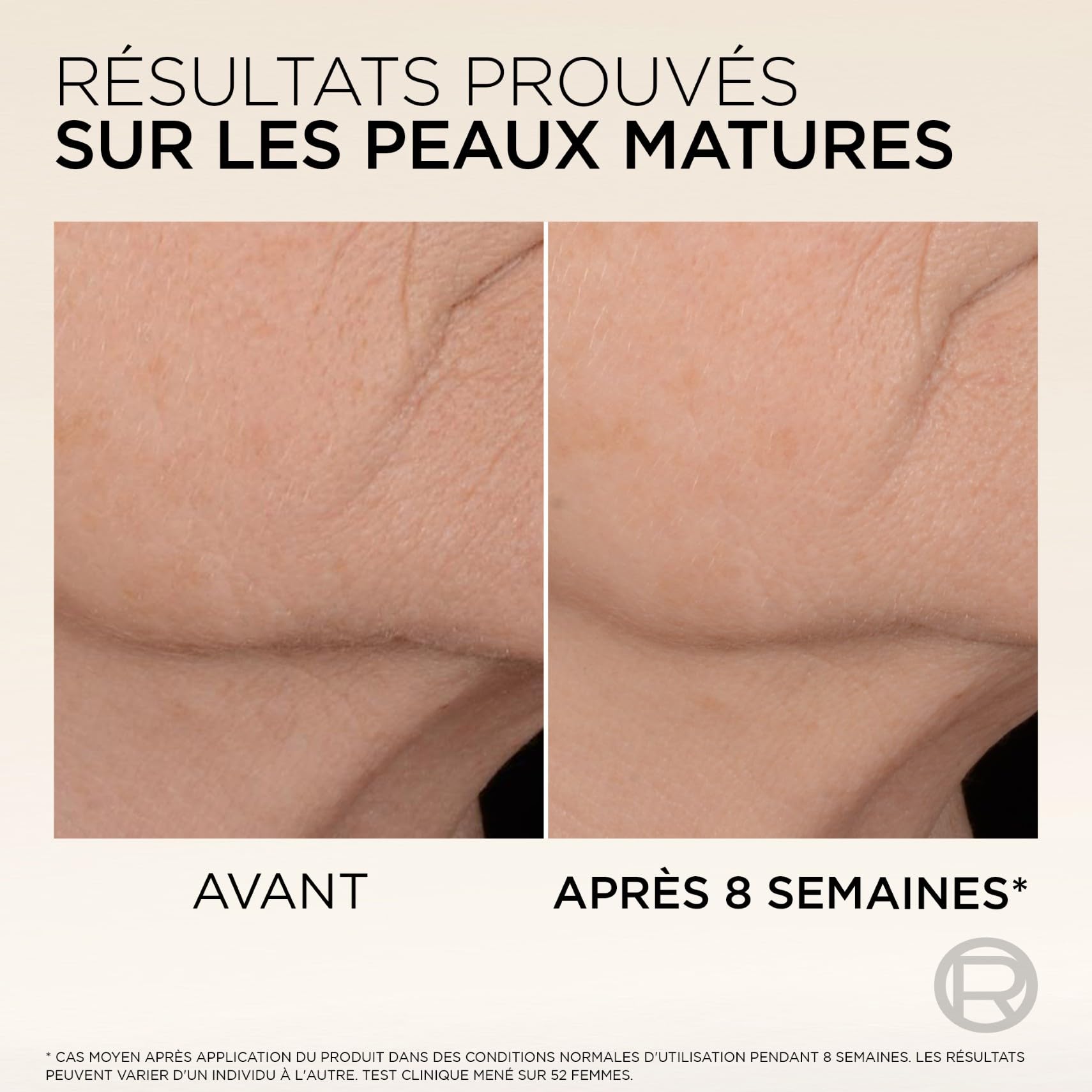 l-or-al-paris-age-perfect-s-rum-anti-rel-chement-peaux-matures-30-ml image 6