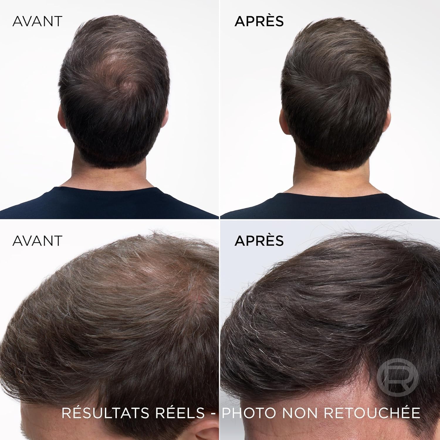 l-or-al-paris-magic-retouch-spray-racines-ch-tain-fonc-75-ml image 4