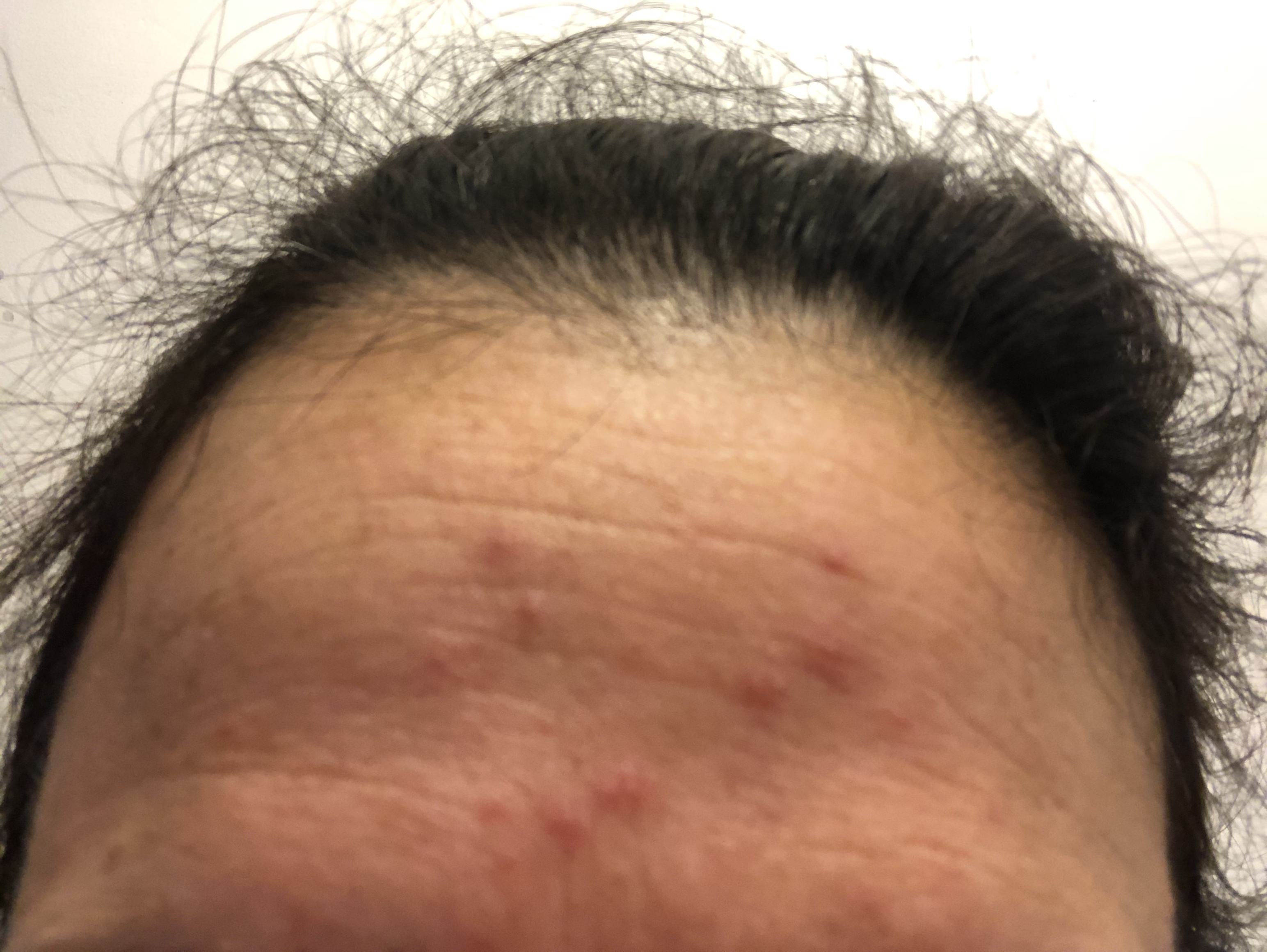 Peau repulpée en une semaine