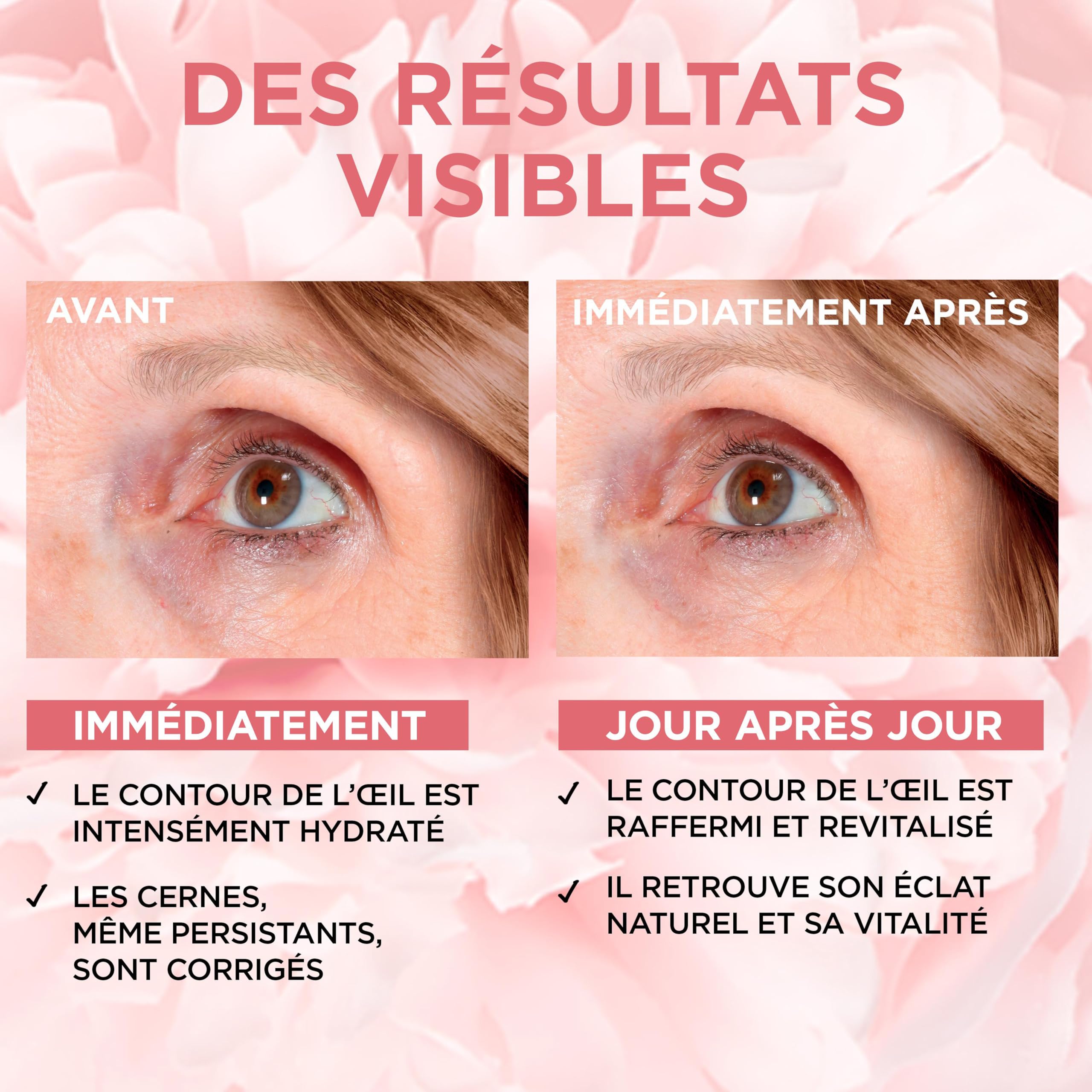 l-or-al-paris-age-perfect-golden-age-soin-ros-clat-contour-des-yeux-15-ml image 4