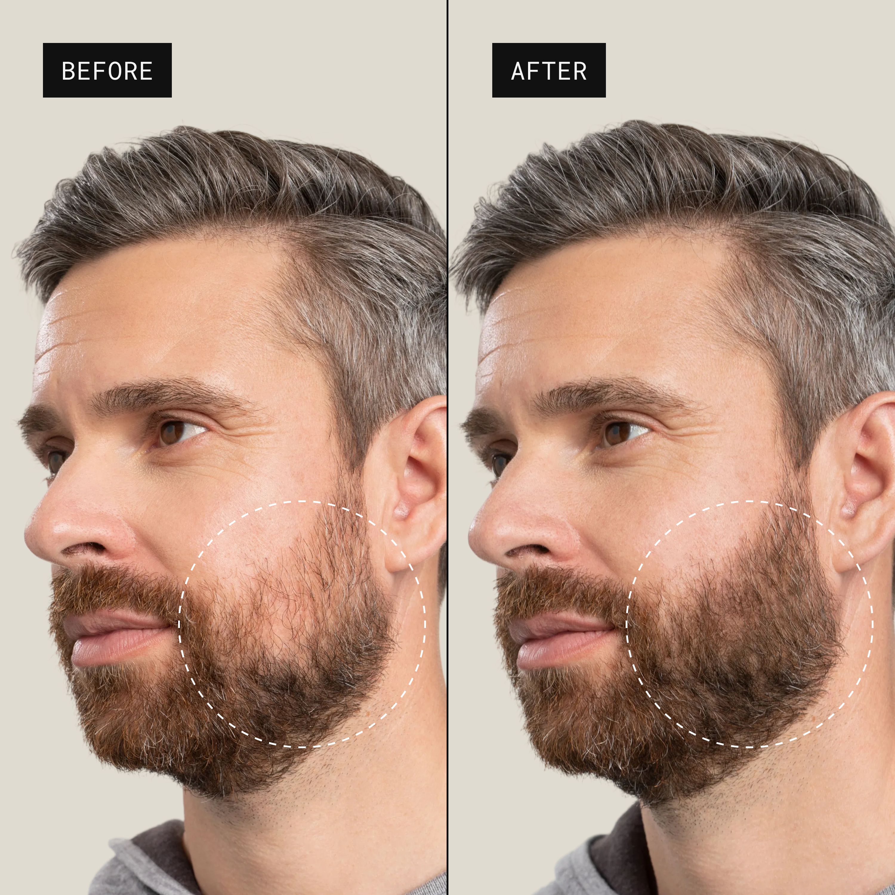 toppik-spray-applicator-applicateur-spray-pr-cision image 4