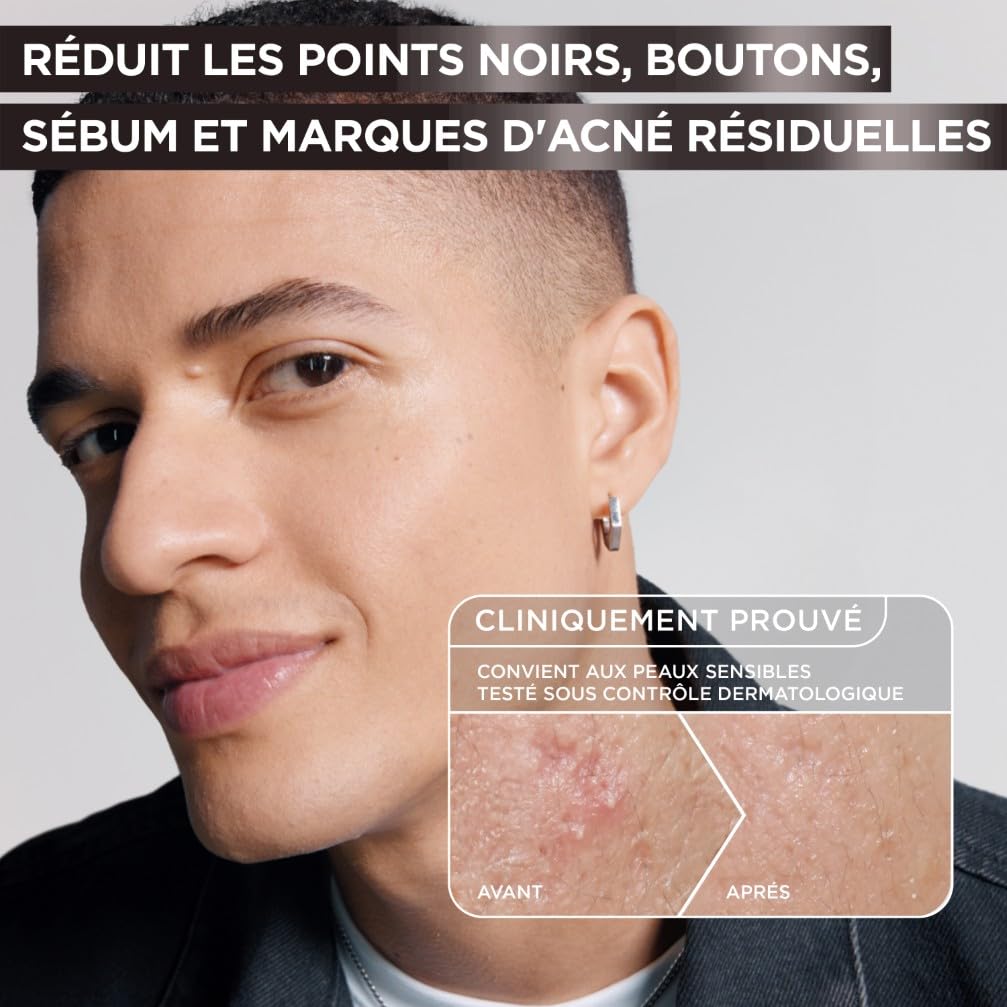garnier-pure-active-s-rum-anti-points-noirs-au-charbon-30-ml image 4